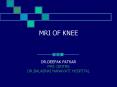 MRI OF KNEE PowerPoint PPT Presentation