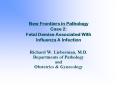 New Frontiers in Pathology Case 2: Fetal Demise Associated With Influenza A Infection PowerPoint PPT Presentation