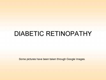 DIABETIC RETINOPATHY