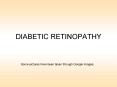 DIABETIC RETINOPATHY PowerPoint PPT Presentation
