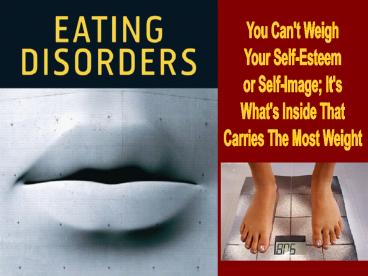 Eating Disorders