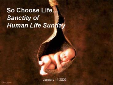 So Choose Life Sanctity of Human Life Sunday