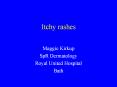 Itchy rashes PowerPoint PPT Presentation