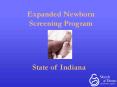 Expanded Newborn Screening Program PowerPoint PPT Presentation