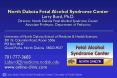 North Dakota Fetal Alcohol Syndrome Center PowerPoint PPT Presentation