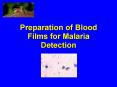 Preparation of Blood Films for Malaria Detection PowerPoint PPT Presentation