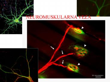 NEUROMUSKULARNA VEZA