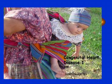 Congenital Heart Disease