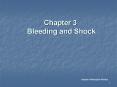 Chapter 3 Bleeding and Shock Nabeel AlMawajdeh RN'Mcs PowerPoint PPT Presentation