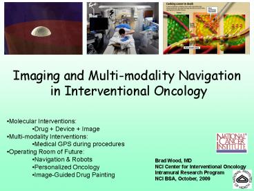 Imaging and Multi-modality Navigation in Interventional Oncology
