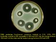 ESBL producing Pseudomonas aeruginosa resistant to CAZ, ATM, FEP, borderline resistant to PIP, susce PowerPoint PPT Presentation