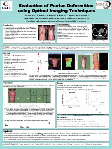 Evaluation of Pectus Deformities using Optical Imaging Techniques