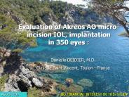 A 400 patients study on new IOL