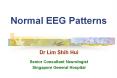 Normal EEG Patterns PowerPoint PPT Presentation