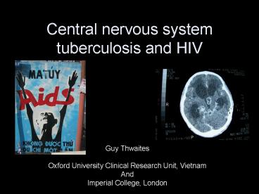 Central nervous system tuberculosis and HIV
