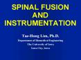 SPINAL FUSION AND INSTRUMENTATION PowerPoint PPT Presentation