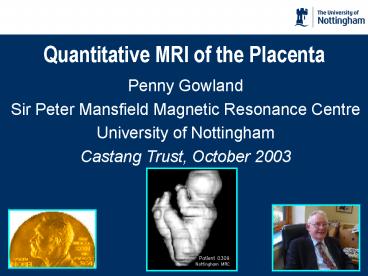 Quantitative MRI of the Placenta