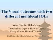 The%20Visual%20outcomes%20with%20two%20different%20multifocal%20IOLs