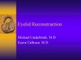 Eyelid Reconstruction PowerPoint PPT Presentation