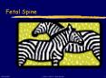Fetal Spine PowerPoint PPT Presentation