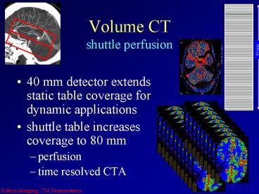 Volume CT shuttle perfusion