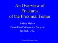An Overview of Fractures of the Proximal Femur PowerPoint PPT Presentation