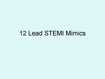 12 Lead STEMI Mimics