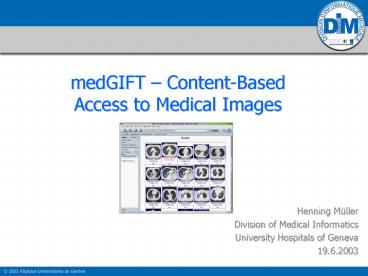 medGIFT ContentBased Access to Medical Images