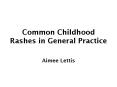 Common Childhood Rashes in General Practice PowerPoint PPT Presentation