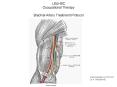 LSUHSC Occupational Therapy Brachial Artery Treatment Protocol PowerPoint PPT Presentation