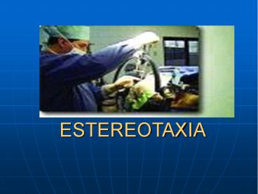 ESTEREOTAXIA