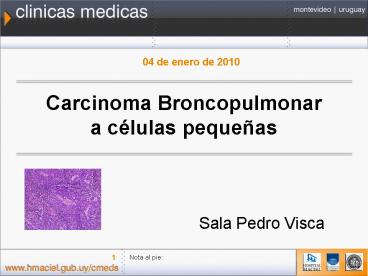 Carcinoma Broncopulmonar a clulas pequeas