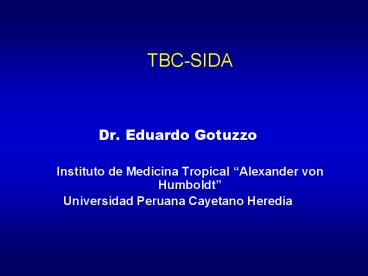 TBC-SIDA
