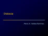Distocia