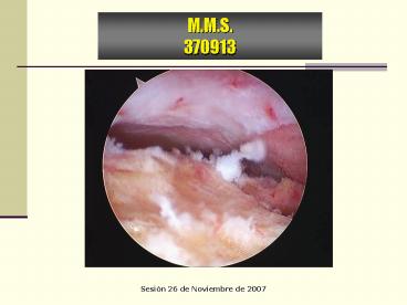 RECONSTRUCCION L'C'A' TECNICA S'A'C'