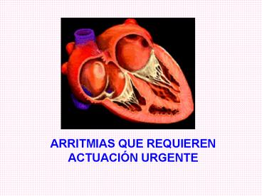 ARRITMIAS QUE REQUIEREN ACTUACIN URGENTE