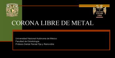 CORONA LIBRE DE METAL