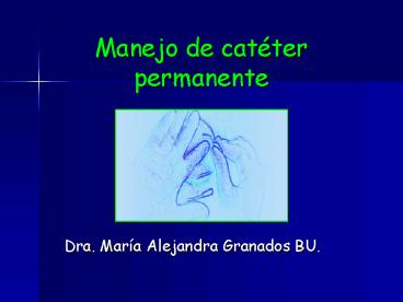 Manejo de catter permanente