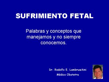 SUFRIMIENTO FETAL