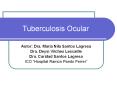 Tuberculosis Ocular PowerPoint PPT Presentation