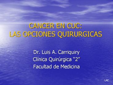 CANCER EN CUC: LAS OPCIONES QUIRURGICAS