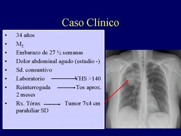 Caso Clnico