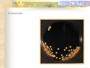 LABORATORIO DE BACTERIOLOGIA H.N. DE CLINICAS