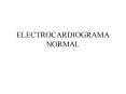 ELECTROCARDIOGRAMA NORMAL PowerPoint PPT Presentation