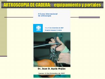 RECONSTRUCCION L'C'A' TECNICA S'A'C'