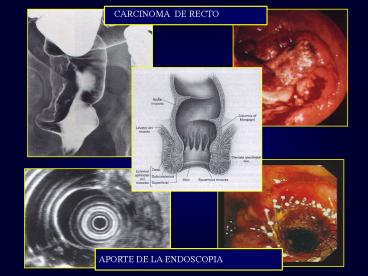 Sin ttulo de diapositiva