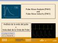 Pulse Wave Analysis PWA and Pulse Wave Velocity PWV PowerPoint PPT Presentation