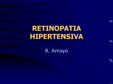 RETINOPATIA HIPERTENSIVA