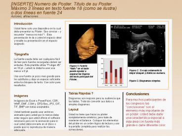 Plantilla Poster