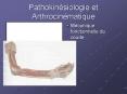 Pathokinsiologie et Arthrocinmatique PowerPoint PPT Presentation